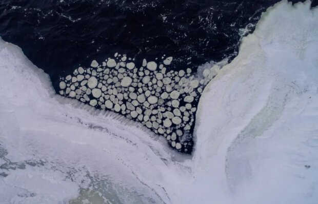 Камни в почках, кадр из видео