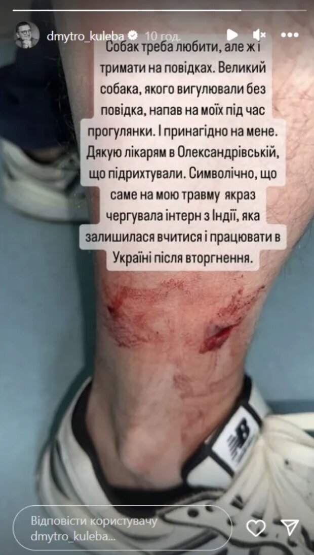 Нападение на Дмитрия Кулебу
