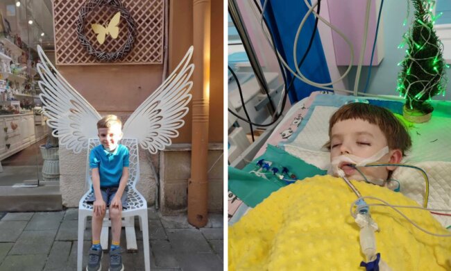 Хлопчик впав у кому після прийому у стоматолога, фото із соцмереж
