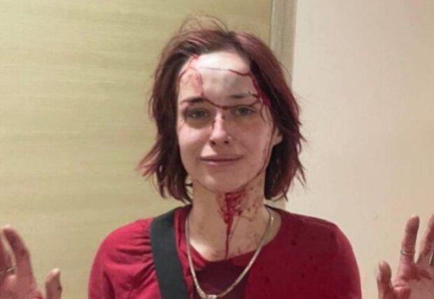 Результат побиття дівчини співробітником ТЦК