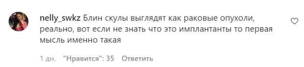 Коментарі зі сторінки Насті Покрищук в Instagram