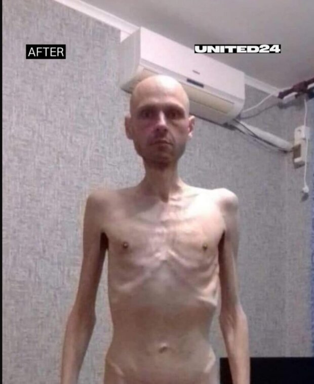 Владимир Цема-Бурсов после плена, фото из соцсетей