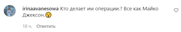 Коментарі на пост Ані Лорак в Instagram